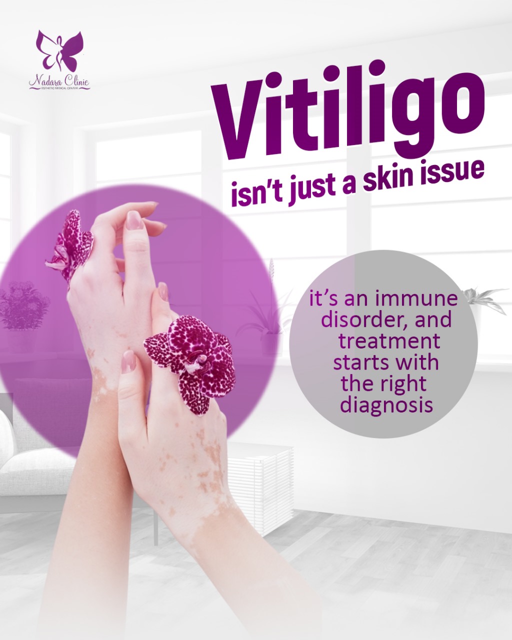 Vitiligo treatment